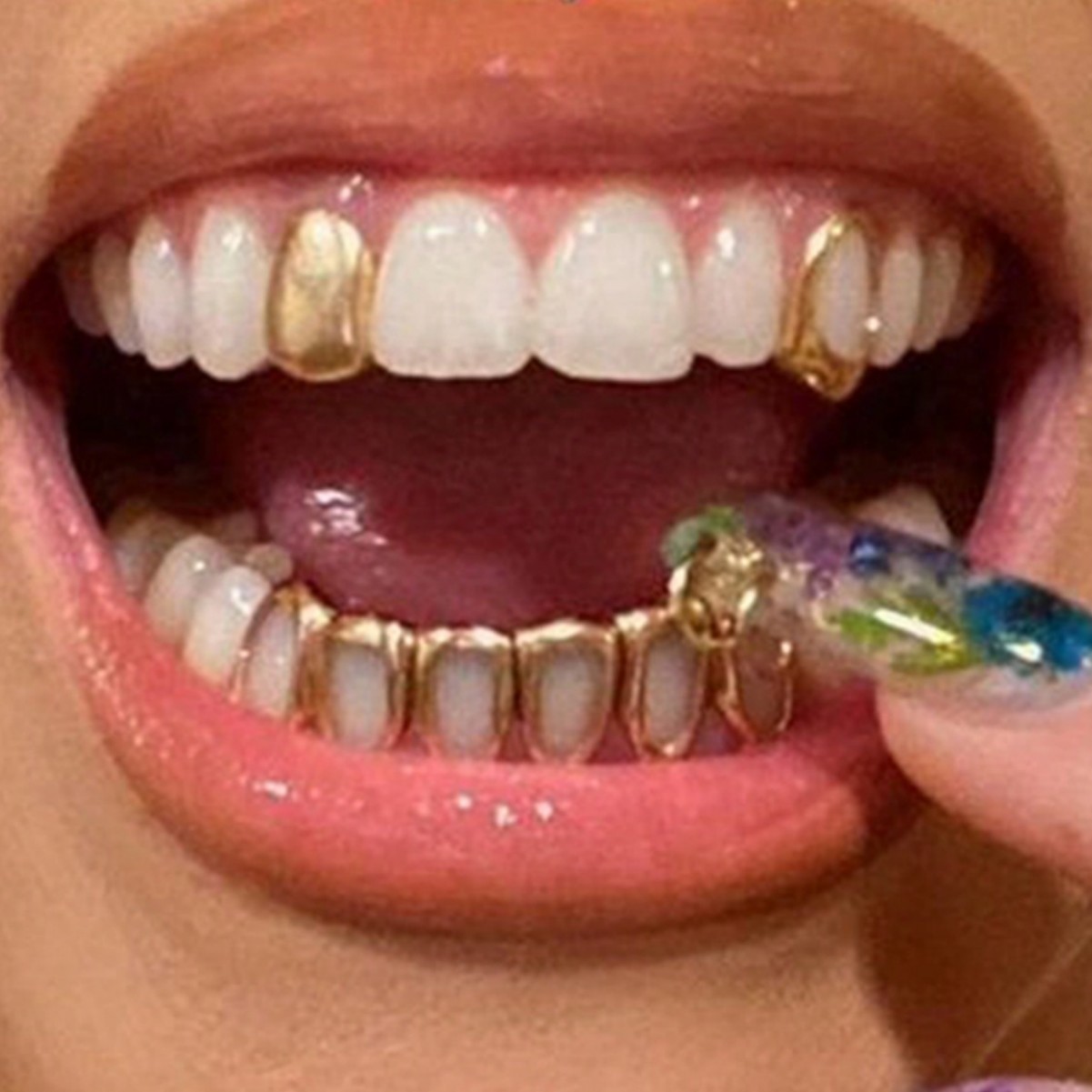 Oferta Especial: Brackets Dent - Body Jewelry Hot reseña y precio